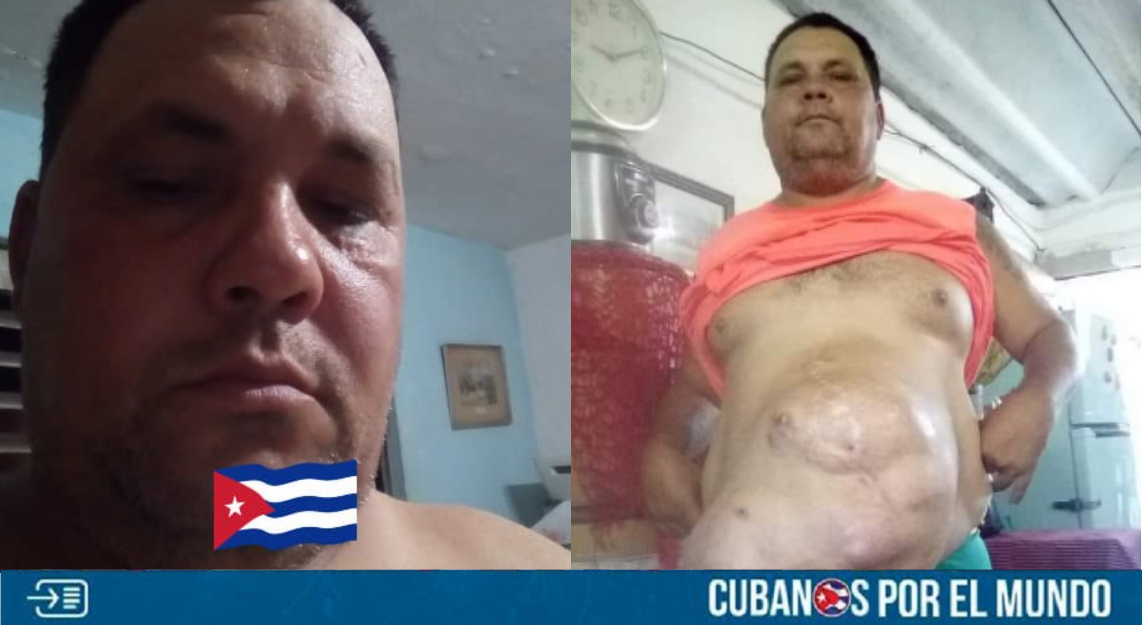 Defensor del régimen pide ayuda monetaria para poder operarse en Cuba