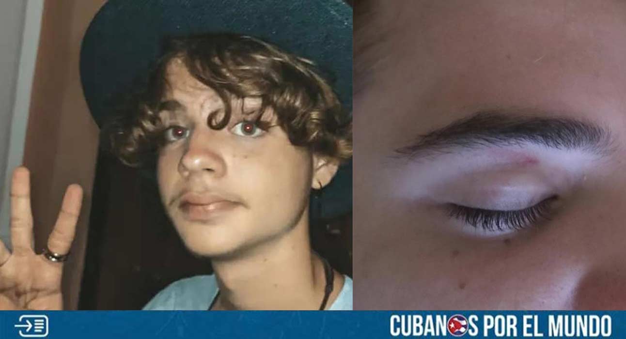 El joven influencer cubano Reniel Rodríguez, quien fue expulsado del IPVCE de Matanzas, sufrió un asalto con un arma blanca para robarle el celular.