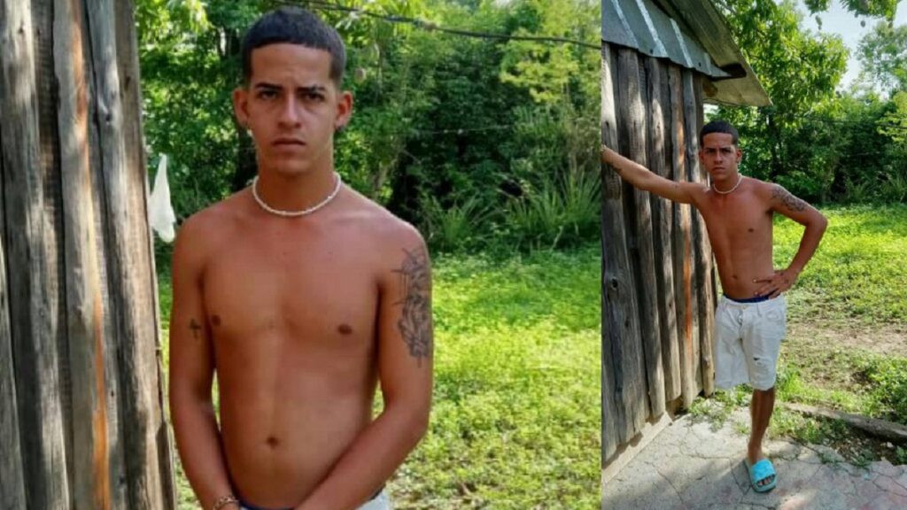 Piden bastones o muletas para joven cubano amputado