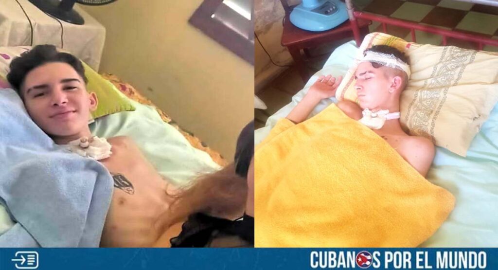 Joven cubano atacado a machetazos en Holguín se sigue recuperando en su casa