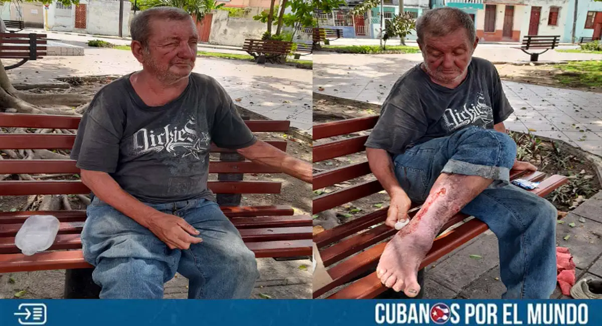 Activista y periodista camagüeyano pide ayuda para anciano enfermo que vive en situación de calle