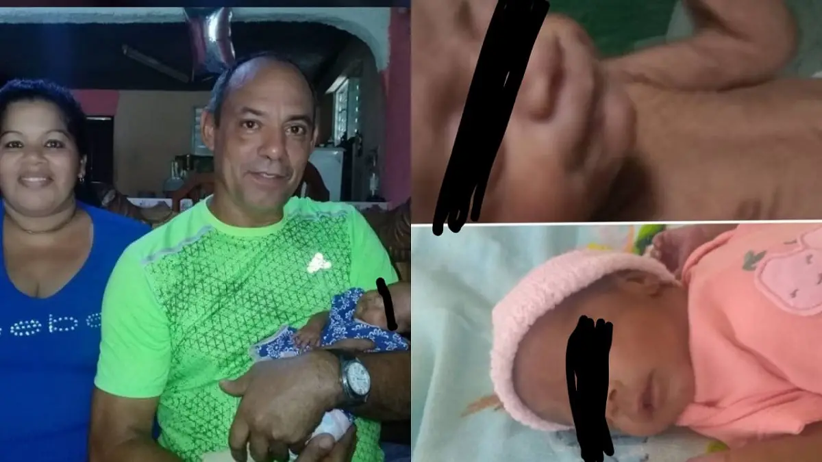 Bebé cubana se recupera en casa tras nacer con 2 libras de peso