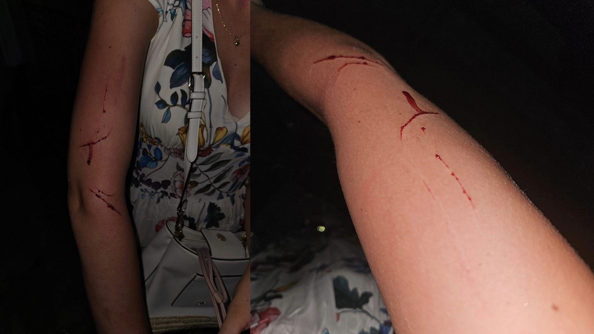 Agreden a cubana para robarla en Guantánamo