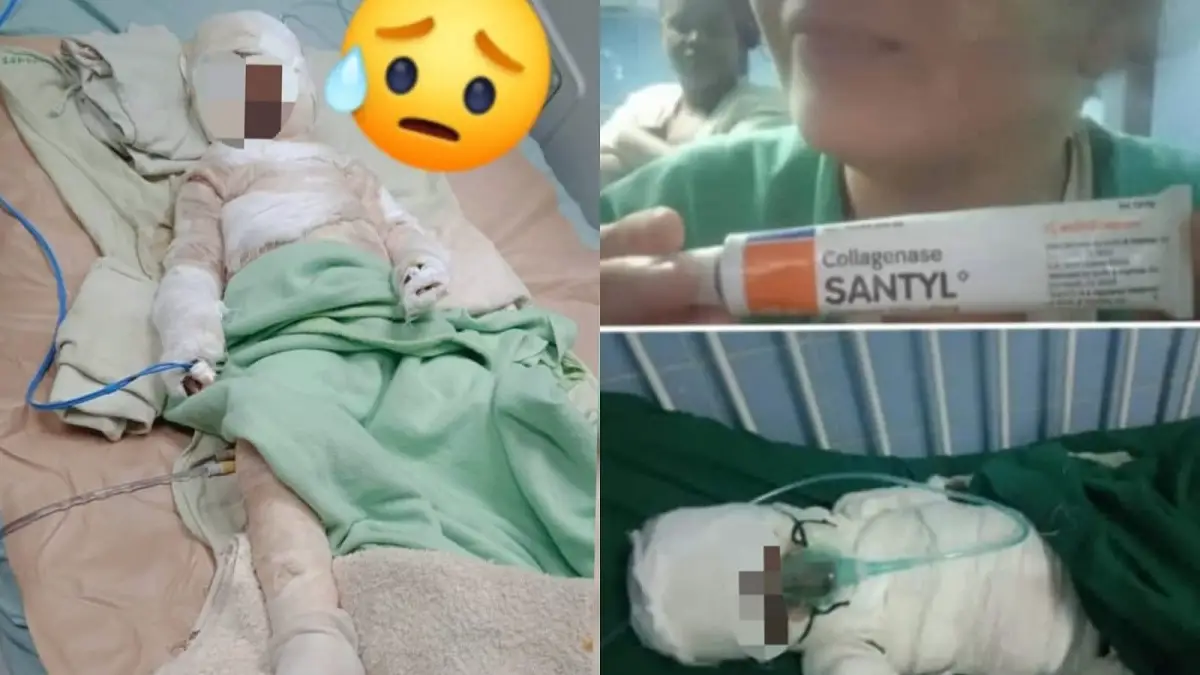 Niño cubano necesita ayuda tras sufrir quemaduras en Pinar del Río