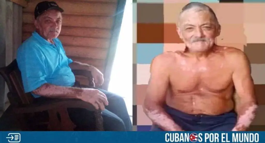 Cubano de Granma lleva dos meses desaparecido; su familia no tiene pistas