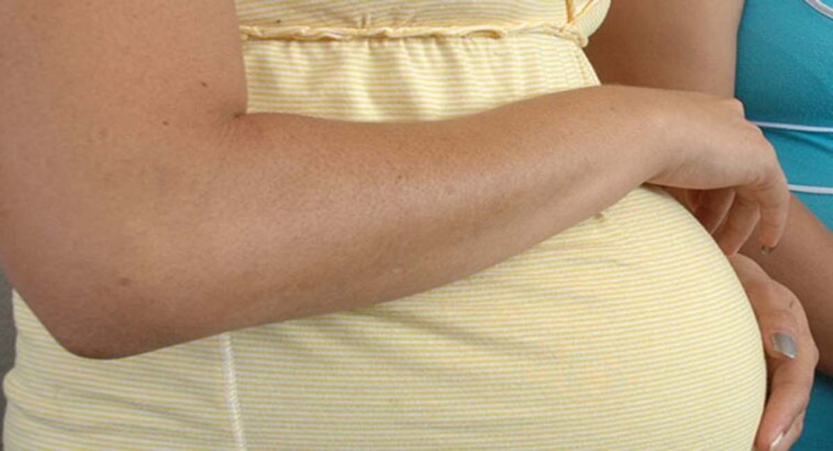 Denuncian que embarazadas cubanas no cuentan con su dieta desde septiembre