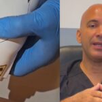Cirujano cubano Youdel Lambert reconocido en Italia por moldear el cuerpo sin intervenciones invasivas