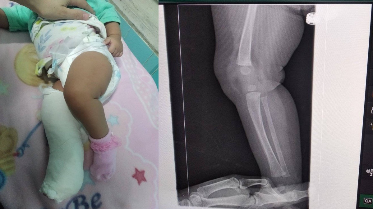 Funcionaria fractura la pierna de una bebé durante violento desalojo en Santiago de Cuba