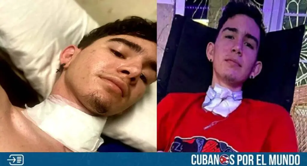 Retiran la traqueotomía al adolescente cubano Lester Domínguez