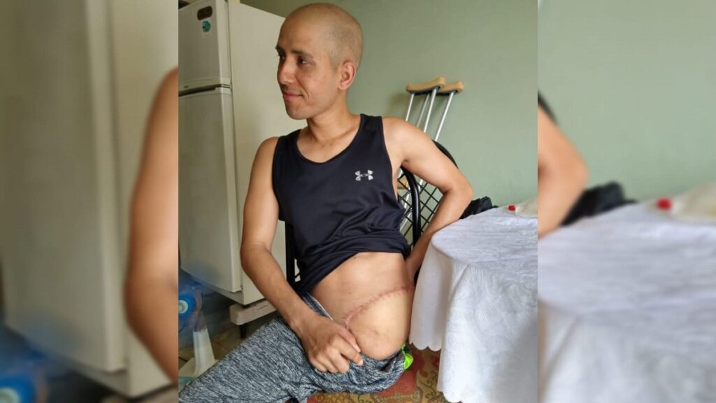 Piden ayuda para cubano con cáncer de huesos y tumor cerebral