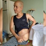 Piden ayuda para cubano con cáncer de huesos y tumor cerebral