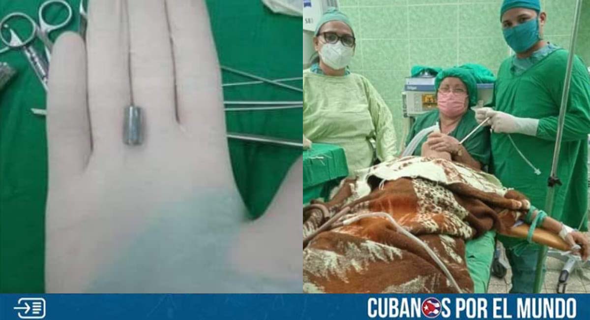 Niño cubano se traga un casquillo de portaminas en Holguín