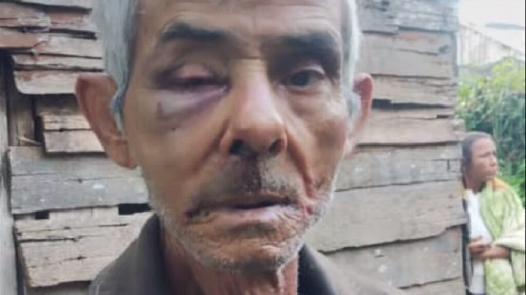 Anciano que vendía dulces en Holguín fue asaltado y golpeado para robarlo