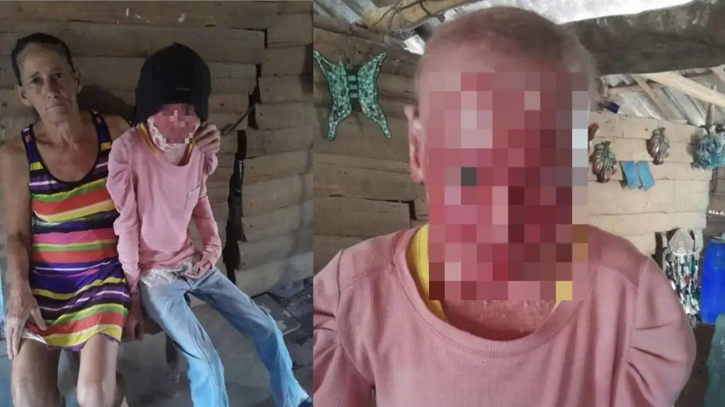 Piden ayuda para niña con enfermedad en la piel en Holguín