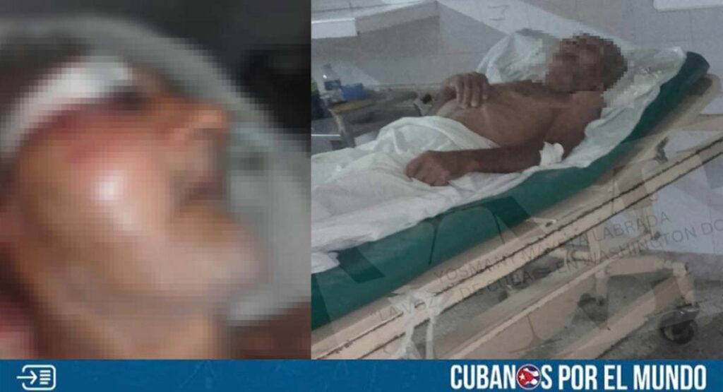 Fallece anciano en Santiago de Cuba por el que pedían ayuda