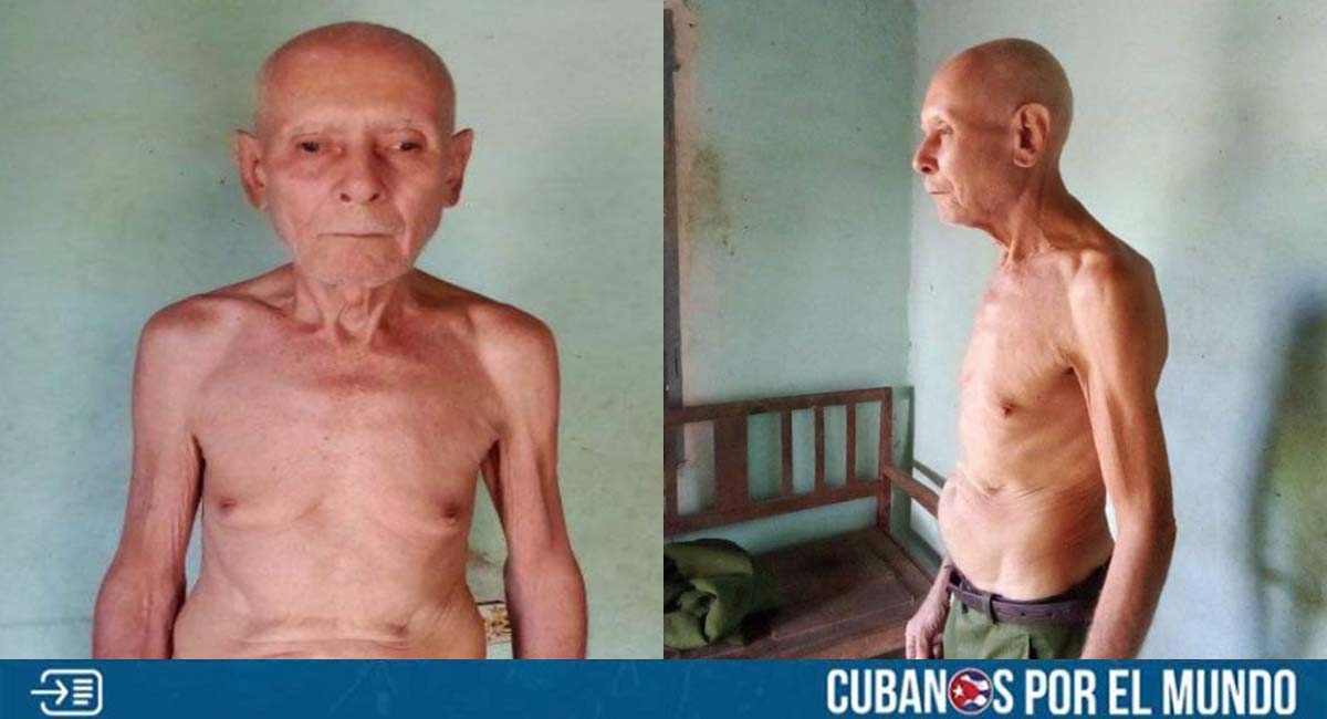 La triste situación de un anciano cubano desamparado en Las Tunas