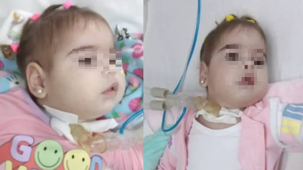 Piden ayuda para niña cubana que no puede respirar por cuenta propia