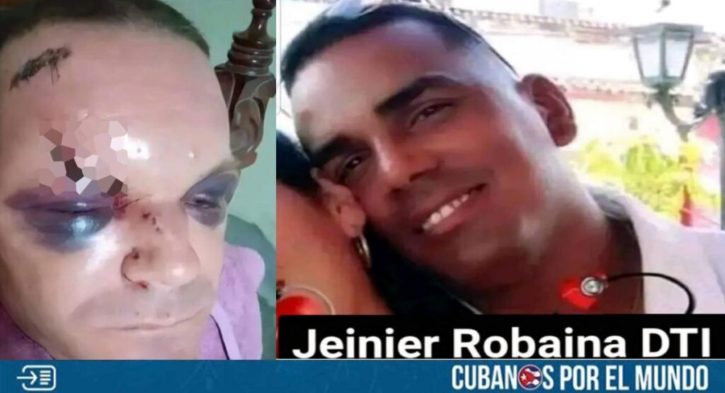 A través de las redes sociales se hizo una petición de justicia para el caso de un cubano que fue golpeado por agentes de la Seguridad del Estado en Manicaragua, provincia de Villa Clara.