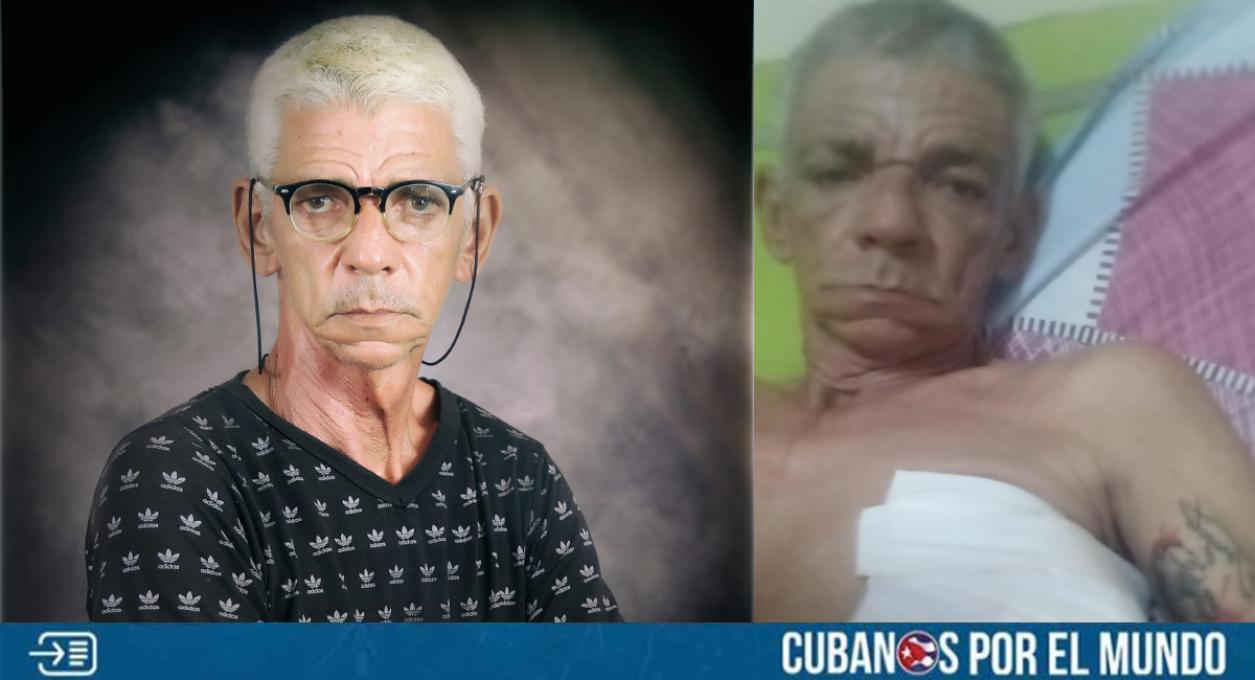 El activista cubano Nelson Álvarez “El Porfiao” sufrió un accidente de moto en la isla, por lo que varias de sus amistades están pidiendo ayuda para él en las redes sociales.