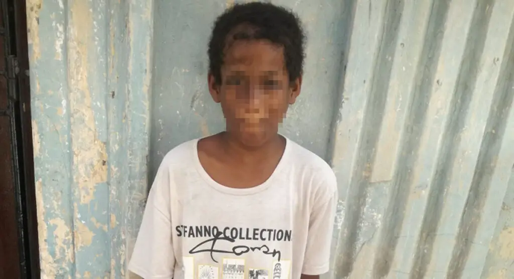 Piden ayuda para niño cubano con lupus en La Habana