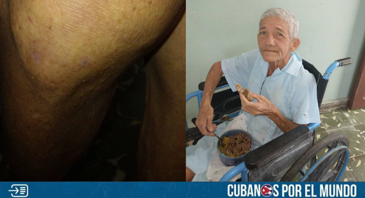 Hogar de ancianos en Granma está repleto de chinches