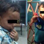 Niño cubano golpeado por su madre se recupera satisfactoriamente