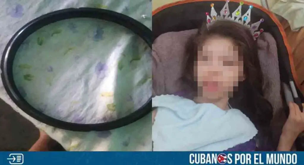 Madre cubana necesita una junta de olla eléctrica para poder cocinarle alimentos a su hija que padece parálisis cerebral