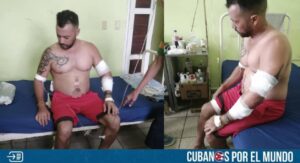 Expelotero cubano víctima de un brutal asalto en La Habana