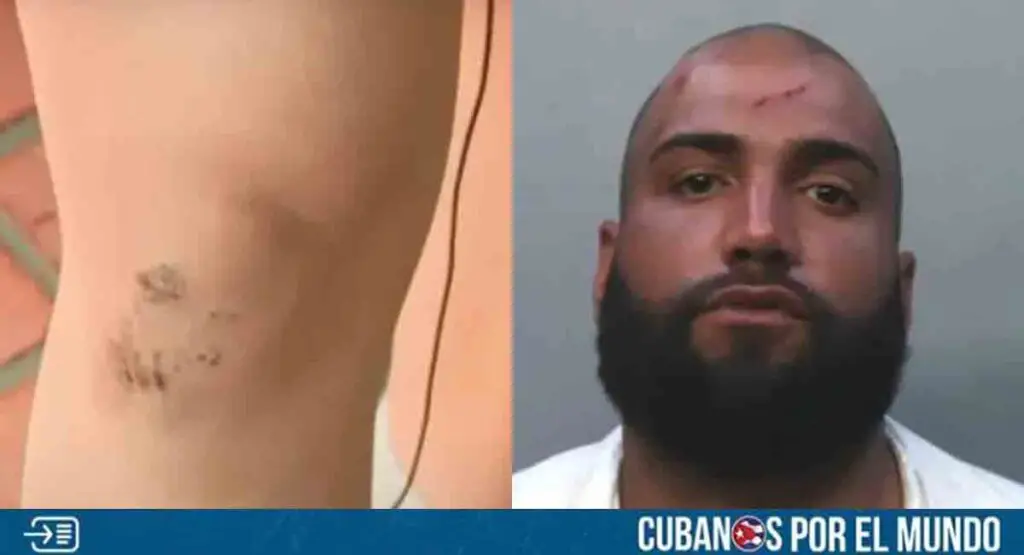 Jovencita de 16 años en Miami cuenta cómo golpeó al hombre que quiso raptarla