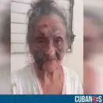 Anciana brutalmente agredida en Camagüey está estable y en su casa