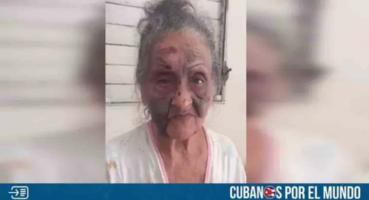 Anciana brutalmente agredida en Camagüey está estable y en su casa