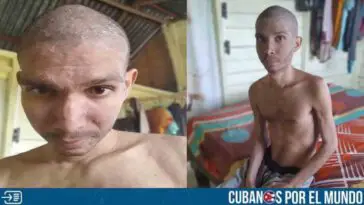 Joven cubano enfermo pide ayuda desesperada