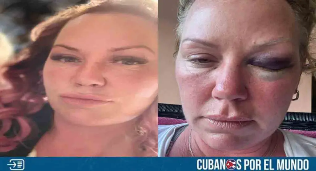 Turista canadiense expone la agresión que sufrió en un hotel de Varadero