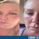 Turista canadiense expone la agresión que sufrió en un hotel de Varadero