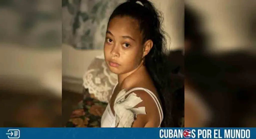 Joven cubana busca apoyo urgente para trasplante de riñón en el extranjero