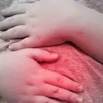 Alertan sobre brote de diarrea en Cuba por combinación de calor y lluvias