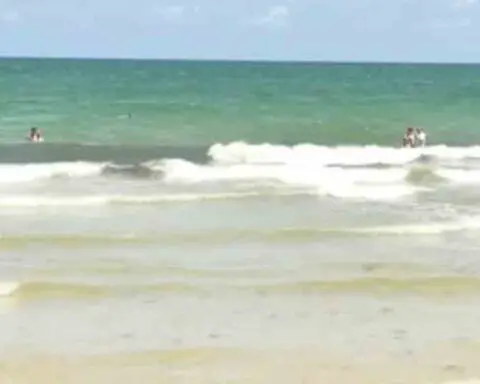 Mujer fue atacada por un animal marino en Florida