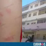 Plaga de chinches en escuelas de Santiago de Cuba pone en peligro a los alumnos