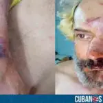 Músico cubano, Eduardo Longa, sufre un brutal asalto en La Habana