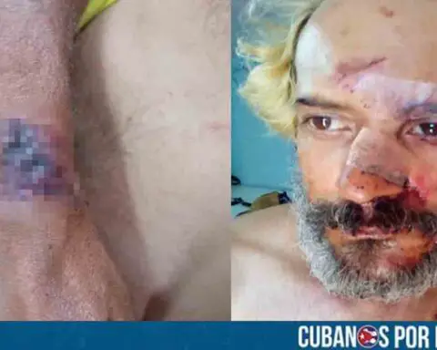 Músico cubano, Eduardo Longa, sufre un brutal asalto en La Habana