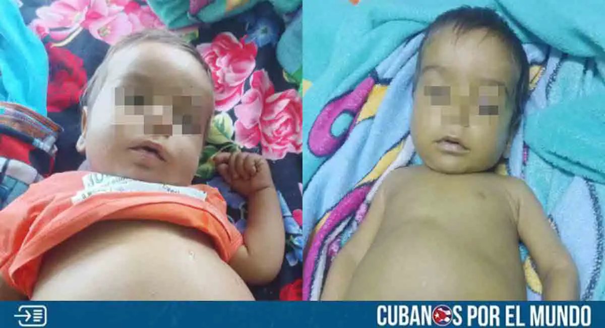 Piden ayuda para salvar la vida de un bebé cubano; necesita un trasplante de hígado