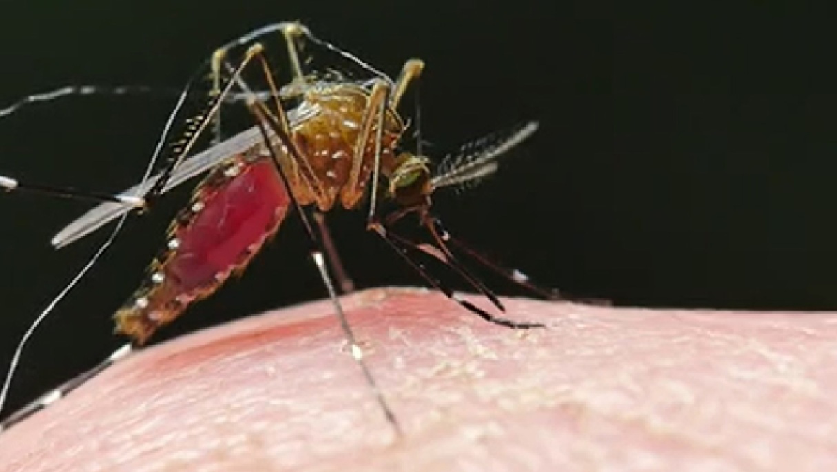 Aumentan los casos de chikungunya en Matanzas a cifras preocupantes