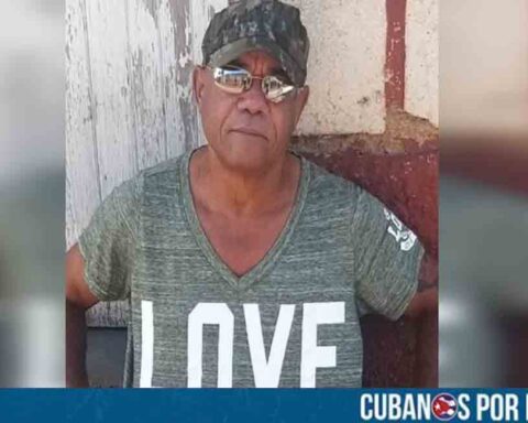 Cubano en Matanzas se arrancó una muela por su cuenta al no encontrar atención médica