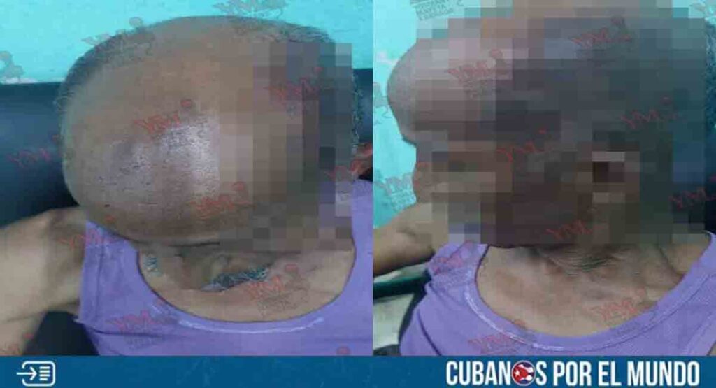 Reportan brutal agresión de un policía a un anciano en Santiago de Cuba