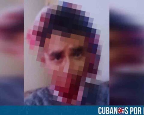 Estudiante de La Habana termina con fractura de cráneo tras violento asalto