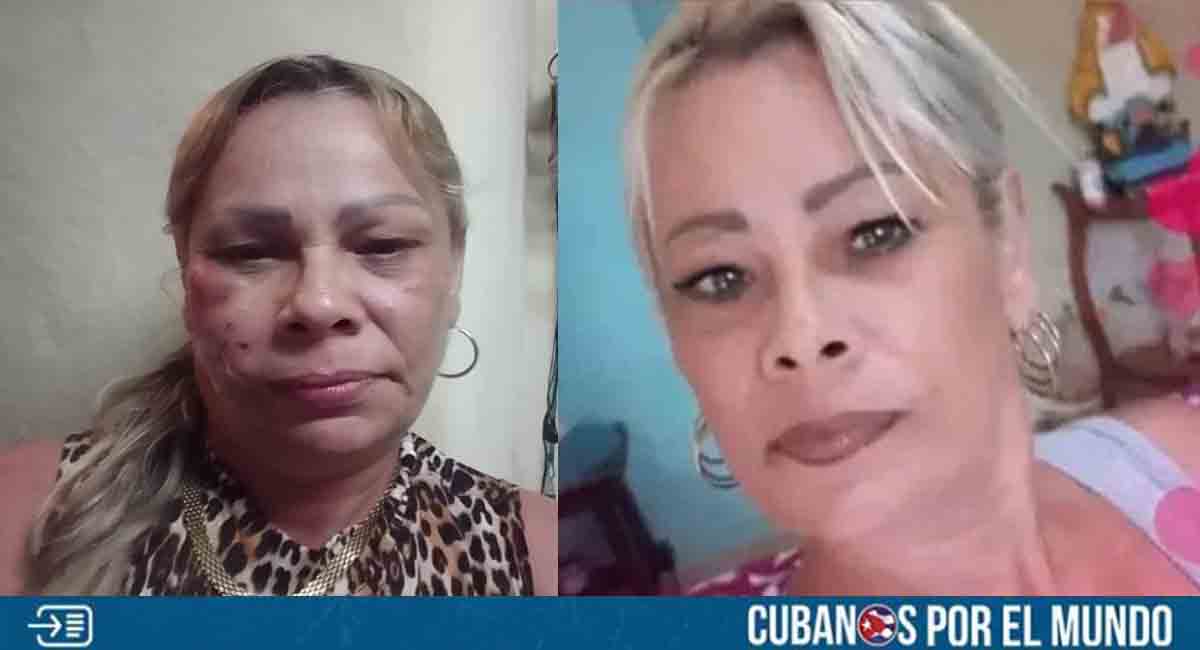 ¡Cobardes! Esbirros castristas secuestraron y golpearon a opositora en La Habana